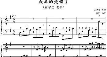 我真的受伤了(钢琴谱) 王菀之作曲 鸠玖